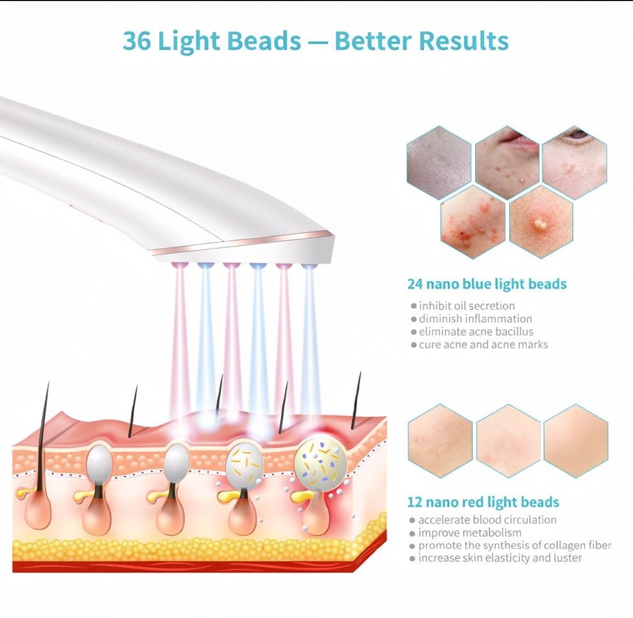 Red Light Therapy Wand - Face Treatment for Skin Renewal & Blemish Removal, Anti-Aging